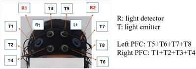 Can the fNIRS-derived neural biomarker better discriminate mild cognitive impairment than a neuropsychological screening test?